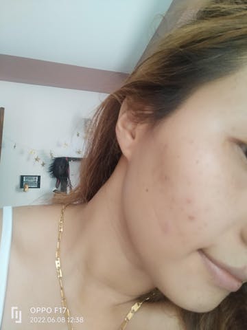 (SKINKRAFT)Yours First Step To Healthy, Glowing Skin